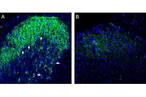 Expression of Connexin-47 in rat spinal cord dorsal horn region.