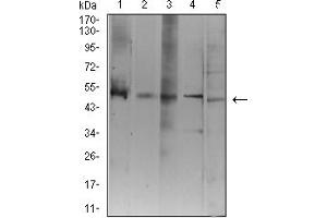 Western blot analysis using ATG3 mouse mAb against Jurkat (1), K562 (2), Hela (3), THP-1 (4), and COS7 (5) cell lysate. (ATG3 anticorps  (AA 1-100))