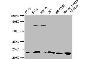 Western blot All lanes: TMEM65 antibody at 1. (TMEM65 anticorps  (AA 63-240))