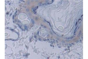 Detection of STAM1 in Rat Skin Tissue using Polyclonal Antibody to Signal Transducing Adaptor Molecule 1 (STAM1)