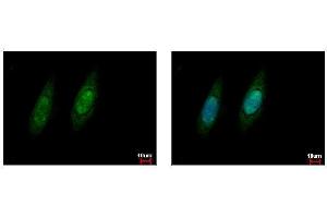 ICC/IF Image VCP antibody detects VCP protein at cytoplasm and nucleus by immunofluorescent analysis. (VCP anticorps  (C-Term))