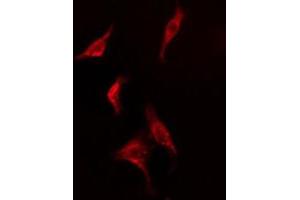 ABIN6278569 staining  HepG2 cells by IF/ICC. (FAF1 anticorps  (C-Term))