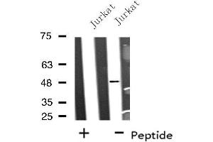 Western blot analysis of extracts from Jurkat cells, using BRE antibody. (BRE anticorps  (C-Term))