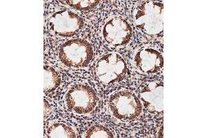 Immunohistochemical analysis of E on paraffin-embedded human colon tissue was performed on the Leica®BOND RXm. (Prohibitin 2 anticorps  (AA 225-255))