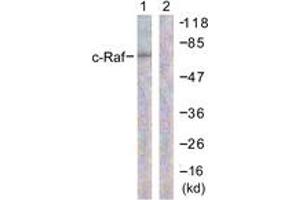Western blot analysis of extracts from 293 cells, treated with PMA 125ng/ml 30' , using C-RAF (Ab-296) Antibody. (RAF1 anticorps  (AA 271-320))