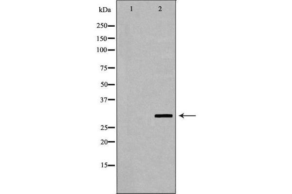FCGR3A anticorps  (C-Term)