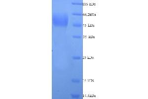 SDS-PAGE (SDS) image for Myeloproliferative Leukemia Virus Oncogene (MPL) (AA 26-491), (Extracellular) protein (His tag) (ABIN5713662)