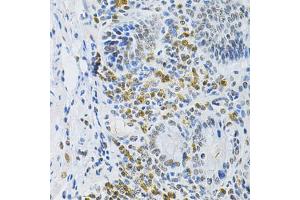 Immunohistochemistry of paraffin-embedded mouse stomach using SMARCE1 Antibody (ABIN5973097) at dilution of 1/200 (40x lens). (SMARCE1 anticorps)