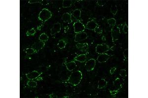 Presynaptic immunostaining of the calyx of Held in the medial nucleus of the trapezoid body (MNTB; dilution 1 : 1000). (SNAP91 anticorps  (AA 279-297))