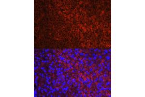 Immunofluorescence analysis of mouse adrenal gland using CYP11 Rabbit pAb (713) at dilution of 1:100 (40x lens).