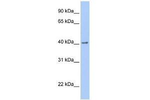 WB Suggested Anti-GFRA2 Antibody Titration: 0. (GFRA2 anticorps  (C-Term))