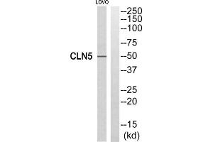 Western blot analysis of extracts from LOVO cells, using CLN5 antibody. (CLN5 anticorps  (Internal Region))