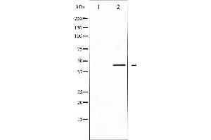 Western blot analysis of extracts from COS-7 cells, using CALR antibody. (Calreticulin anticorps  (N-Term))