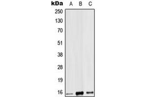 Western blot analysis of IL-9 expression in HEK293T (A), mouse heart (B), rat heart (C) whole cell lysates. (IL-9 anticorps  (Center))