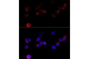 Immunofluorescence analysis of NIH/3T3 cells using Filamin A antibody (ABIN7267206) at dilution of 1:100 (40x lens). (Filamin A anticorps  (C-Term))