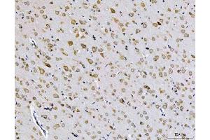 IHC analysis of EIF3A using anti-EIF3A antibody (ABIN7599942).