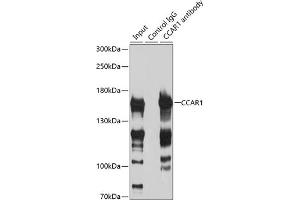 Immunoprecipitation analysis of 200 μg extracts of HeLa cells using 3 μg CC antibody (ABIN6129224, ABIN6138030, ABIN6138032 and ABIN6217655). (CCAR1 anticorps  (AA 1-200))