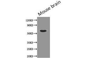 Western Blot Positive WB detected in: Mouse brain tissue All lanes: PODXL antibody at 0.