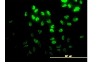 Immunofluorescence of monoclonal antibody to DPH2 on HeLa cell. (DPH2 anticorps  (AA 125-235))