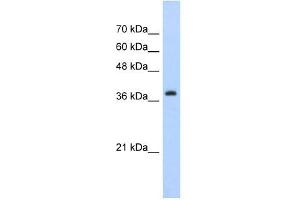 Western Blot showing CBX6 antibody used at a concentration of 1-2 ug/ml to detect its target protein. (CBX6 anticorps  (C-Term))