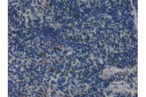 anti-Interleukin 2 (IL2) (AA 10-169) antibody