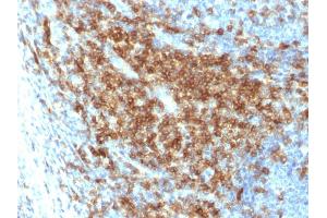 Formalin-fixed, paraffin-embedded human Tonsil stained with CD43 Rabbit Recombinant Monoclonal Antibody (SPN/2049R). (Recombinant CD43 anticorps)