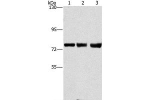 Western Blot analysis of MCF7, hela and 293T cell using GGCX Polyclonal Antibody at dilution of 1:400 (GGCX anticorps)