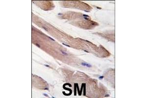 Formalin-fixed and paraffin-embedded human skeletal muscle tissue reacted with PIK3R1-p, which was peroxidase-conjugated to the secondary antibody, followed by DAB staining.