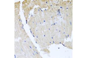 Immunohistochemistry of paraffin-embedded mouse heart using RAB24 antibody at dilution of 1:100 (x40 lens). (RAB24 anticorps)