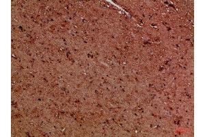 Immunohistochemical analysis of paraffin-embedded Human-brain, antibody was diluted at 1:100 (EYA1 anticorps)