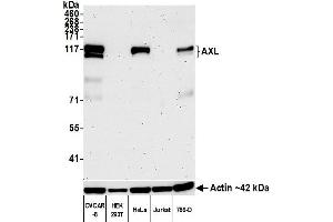 Western Blotting (WB) image for anti-AXL Receptor tyrosine Kinase (AXL) (AA 33-440) antibody (ABIN7453376)