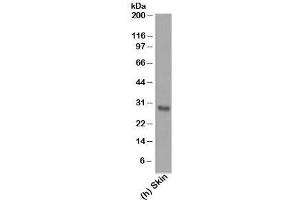Western blot testing of human samples using Bcl-2 antibody (124). (Bcl-2 anticorps  (AA 41-54))
