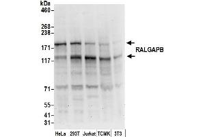 anti-Ral GTPase Activating Protein, beta Subunit (Non-Catalytic) (RALGAPB) (AA 1025-1075) antibody