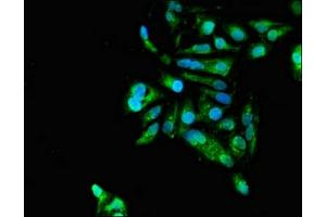 Immunofluorescent analysis of Hela cells using ABIN7154490 at dilution of 1:100 and Alexa Fluor 488-congugated AffiniPure Goat Anti-Rabbit IgG(H+L)