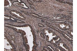 (ABIN184679) (8 μg/mL) staining of paraffin embedded Human Prostate. (NUMB anticorps  (C-Term))