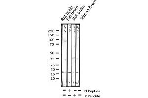 Western blot analysis of Phospho-Histone H3.