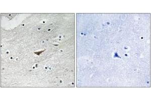 Immunohistochemistry analysis of paraffin-embedded human brain, using VE-Cadherin (Phospho-Tyr731) Antibody. (Cadherin 5 anticorps  (pTyr731))