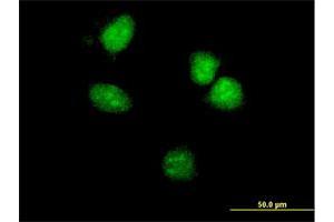 Immunofluorescence of monoclonal antibody to HOXA5 on HeLa cell. (HOXA5 anticorps  (AA 171-270))