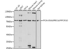 Western blot analysis of extracts of various cell lines, using PP2A-B56δ/PR61δ/PP2A-B56δ/PR61δ/PPP2R5D antibody (ABIN7269690) at 1:1000 dilution.