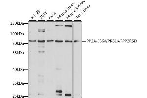 Western blot analysis of extracts of various cell lines, using PP2A-B56δ/PR61δ/PP2A-B56δ/PR61δ/PPP2R5D antibody (ABIN7269690) at 1:1000 dilution. (PPP2R5D anticorps  (AA 450-550))