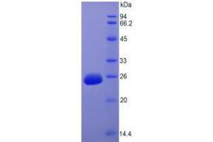 SDS-PAGE analysis of Rat FGF15 Protein. (FGF15 Protéine)