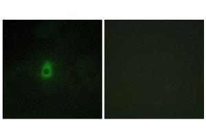 Immunofluorescence (IF) image for anti-Cytochrome P450, Family 2, Subfamily E, Polypeptide 1 (CYP2E1) (C-Term) antibody (ABIN1850358) (CYP2E1 anticorps  (C-Term))