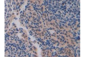 Detection of CDH16 in Mouse Ovary Tissue using Polyclonal Antibody to Cadherin 16 (CDH16)