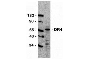 Western Blotting (WB) image for anti-Drought-Repressed 4 Protein (DR4) (C-Term) antibody (ABIN1030366)