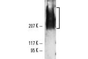Western blot analysis of TRA-1-81 expression using TRA-1-81 monoclonal antibody, clone TRA-1-81  in NTERA-2 cl. (TRA1-81 anticorps)
