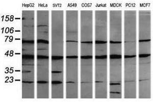 Image no. 1 for anti-Mitogen-Activated Protein Kinase Kinase 1 (MAP2K1) antibody (ABIN1499374) (MEK1 anticorps)
