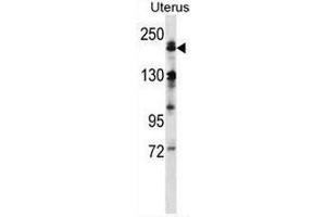 Western blot analysis of MEKK4 Antibody (Center) Cat.