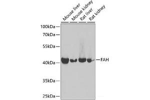 Western blot analysis of extracts of various cell lines using FAH Polyclonal Antibody at dilution of 1:1000. (FAH anticorps)