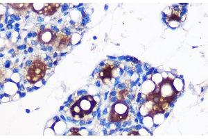 Immunohistochemistry of paraffin-embedded Rat fat using UCP1 Polyclonal Antibody at dilution of 1:100 (40x lens). (UCP1 anticorps)