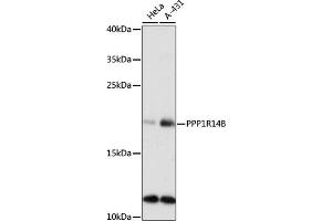 Western blot analysis of extracts of various cell lines, using PPP1R14B antibody (ABIN7269675) at 1:1000 dilution. (PPP1R14B anticorps  (AA 68-147))